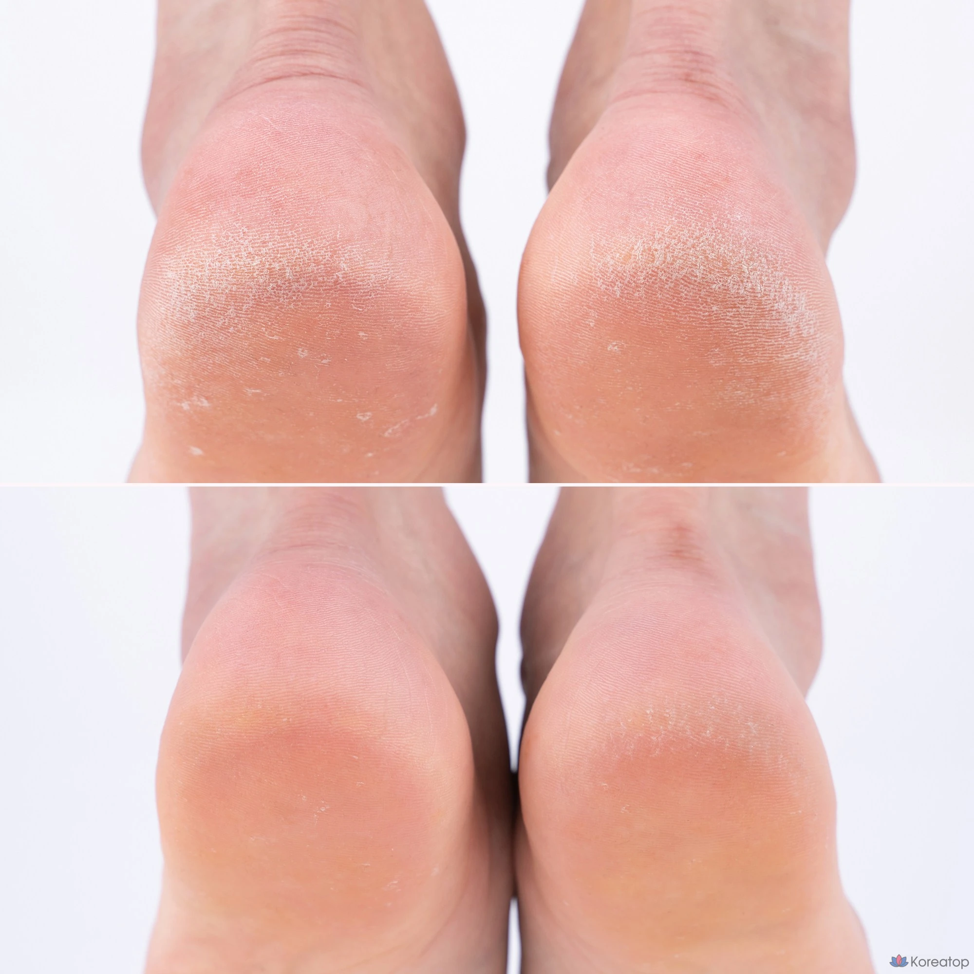 Увлажняющие и отшелушивающие носки для ног Rubelli, 40 г, 3 упаковки, 1 упаковка, 3 упаковки