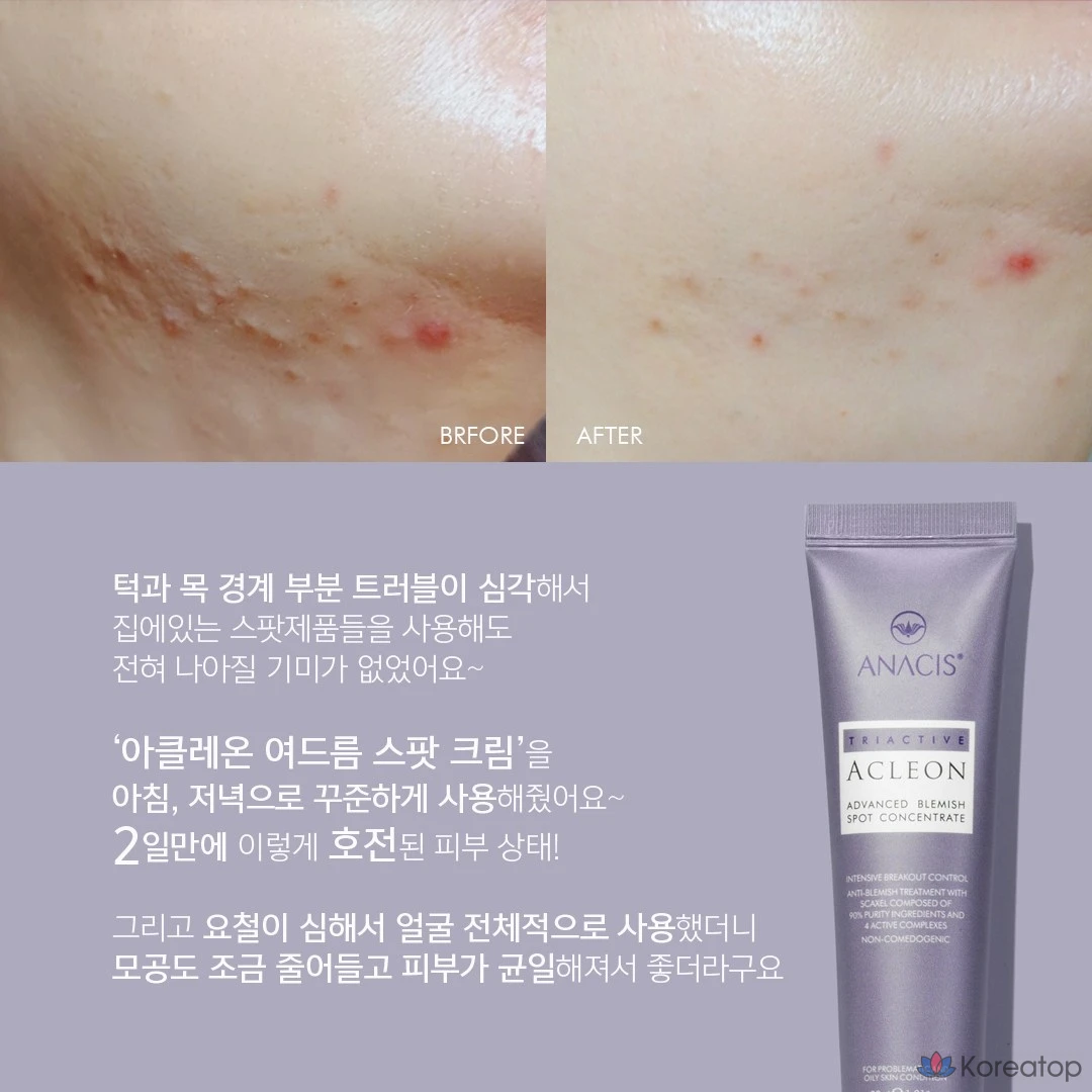 Крем для лица ANACIS Skin Whitehead Trouble Tea Tree Centella Spot, 1 шт., 30 мл