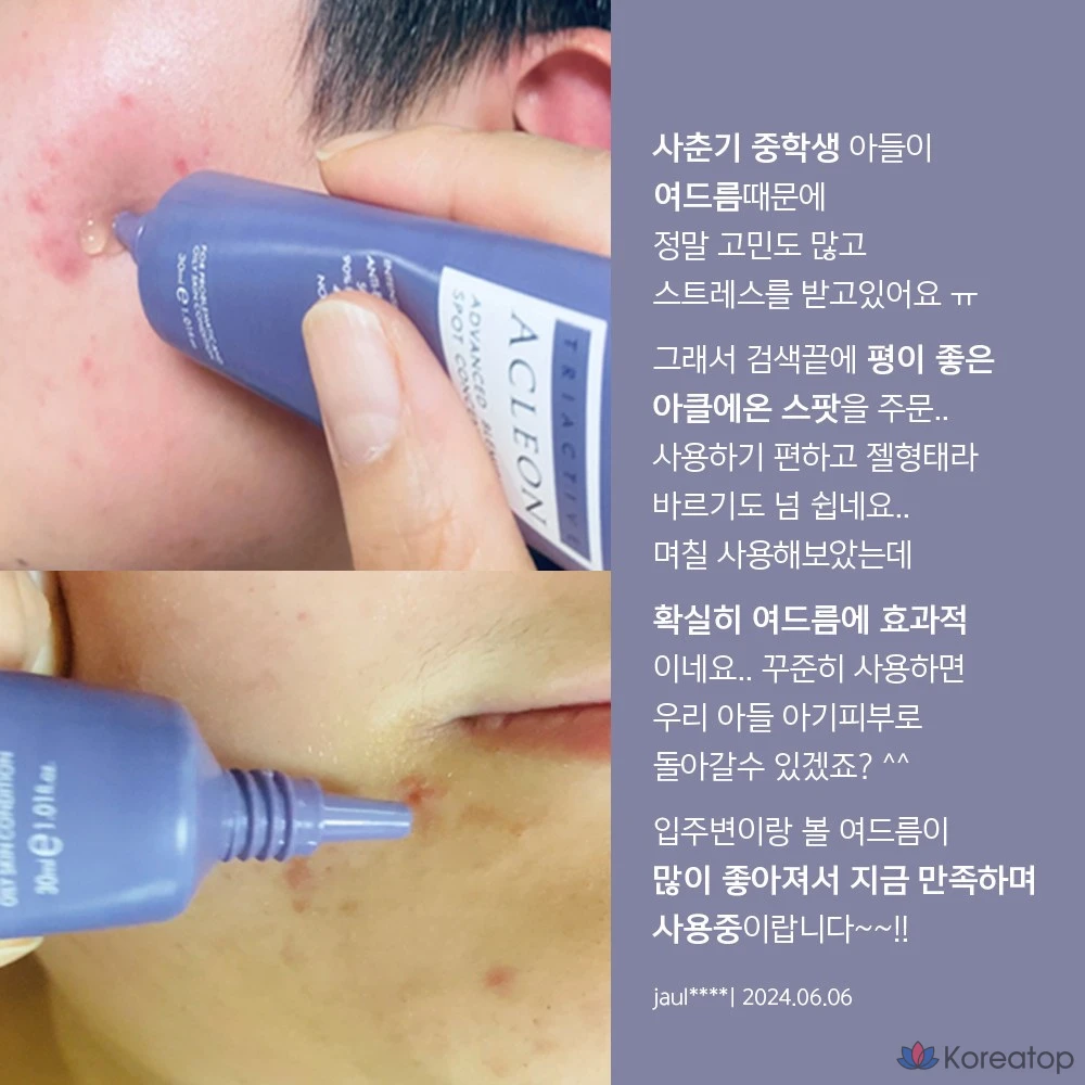 Крем для лица ANACIS Skin Whitehead Trouble Tea Tree Centella Spot, 1 шт., 30 мл