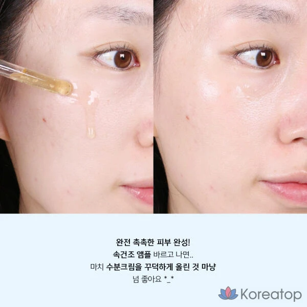 Artbox/ANACIS Leadermiss Resync Средство от акне с гиалуроновой кислотой в ампулах, 55 мл, 1 шт., 20 мл