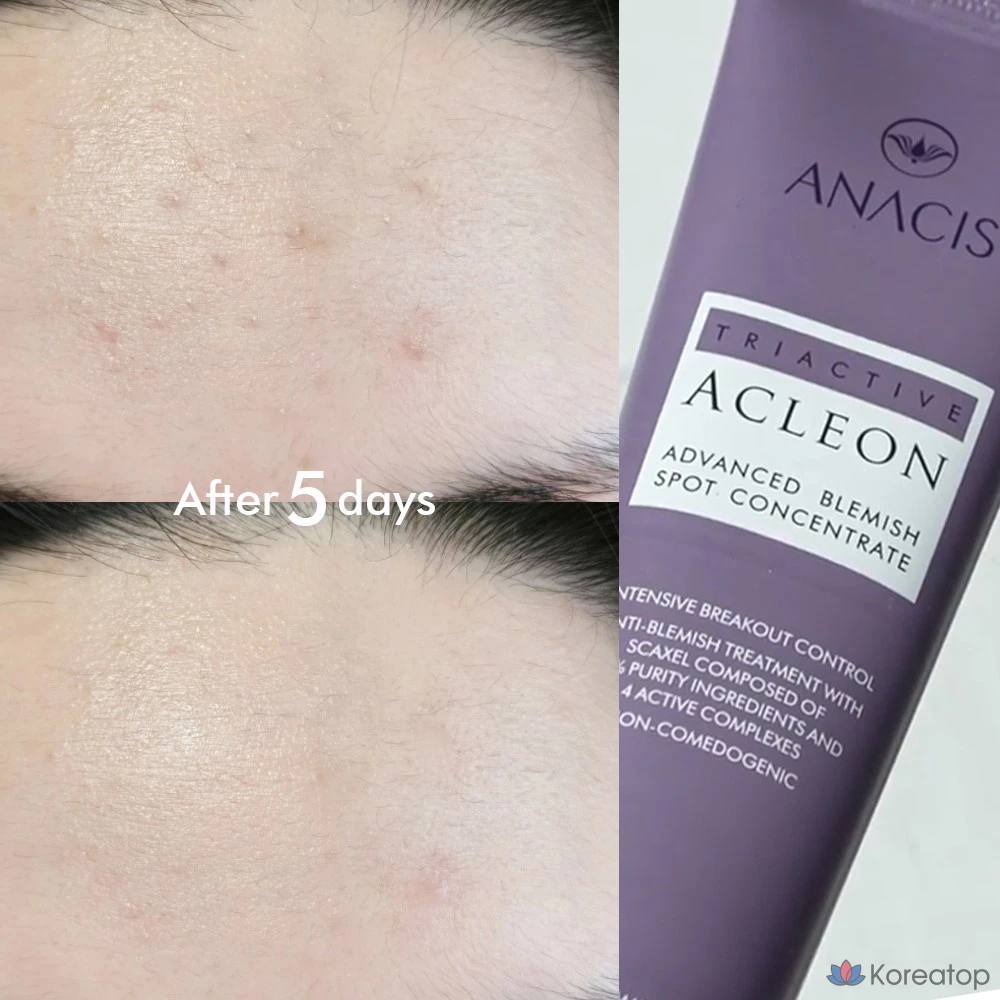 Крем для лица ANACIS Skin Whitehead Trouble Tea Tree Centella Spot, 1 шт., 30 мл