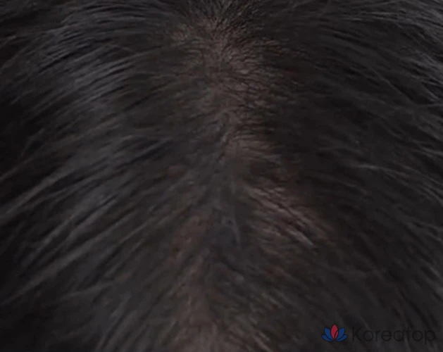 Крем для лица DASHU Daily Slim Quick Hairline Cushion, 2,5 г, натуральный черный, 1 шт.