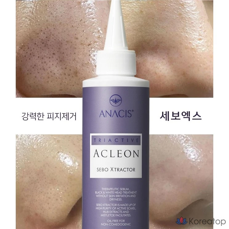 Смягчающее кожное сало ANACIS Seboex, сужение пор, удаление черных точек, очищение кожи головы, 1 шт., 200 мл